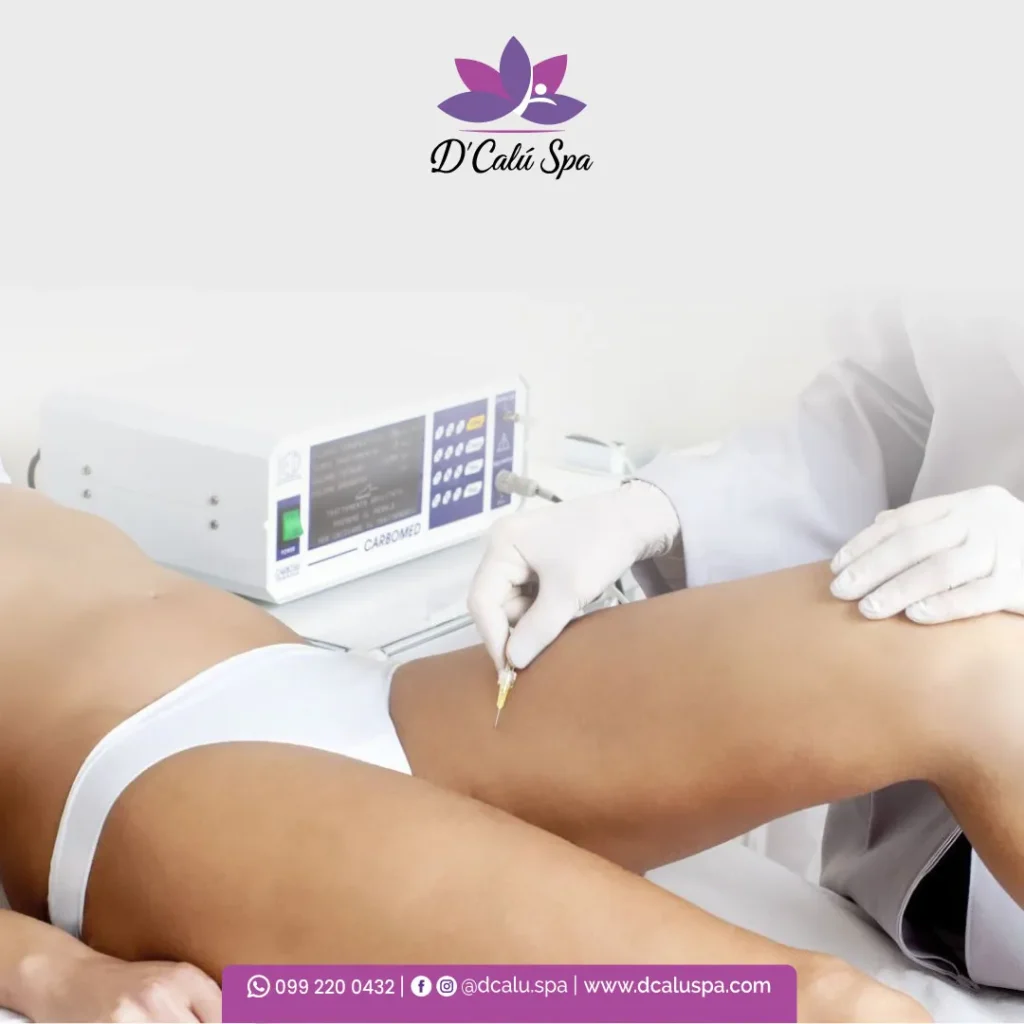 Dcalu-Spa_Tratamientos-Carboxiterapia